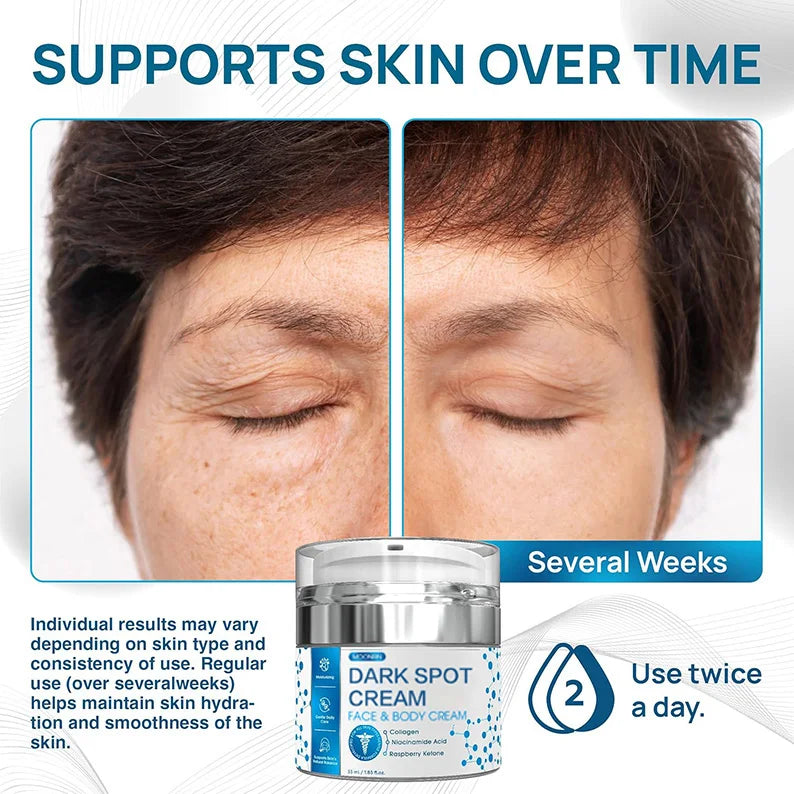 Value Bundle Package of 3 1.85 Fl oz 55 ml Moisturizing Skin Lightening Cream Dark Spot Corrector Collagen Niacinamide Acid